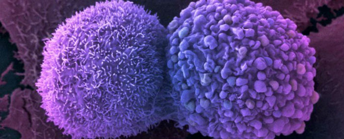 Остановлен рост раковых клеток