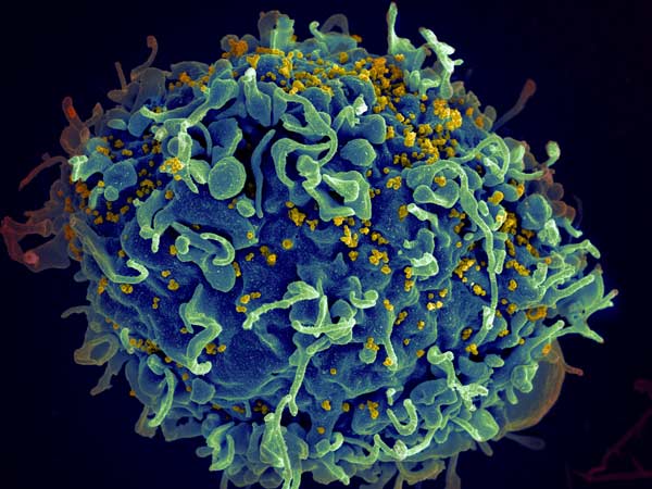 Иллюстрация ВИЧ-инфекции, поражающей клетку человека